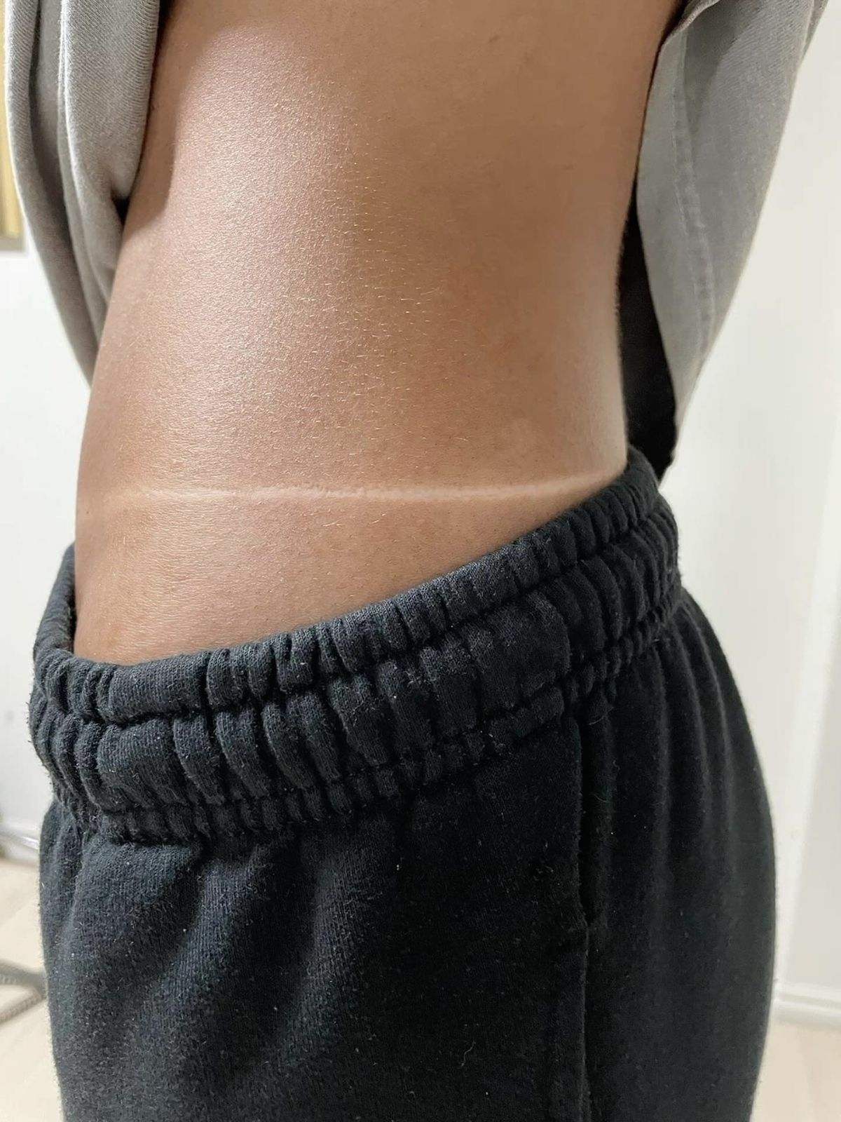 A spray tan on a client’s waist, with a crisp line above black track pants